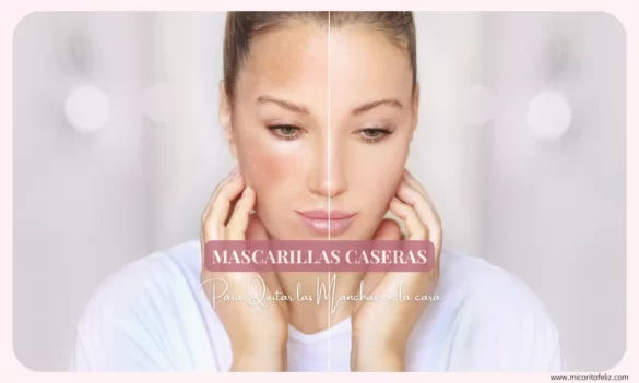 Mascarillas caseras para quitar las manchas en la cara